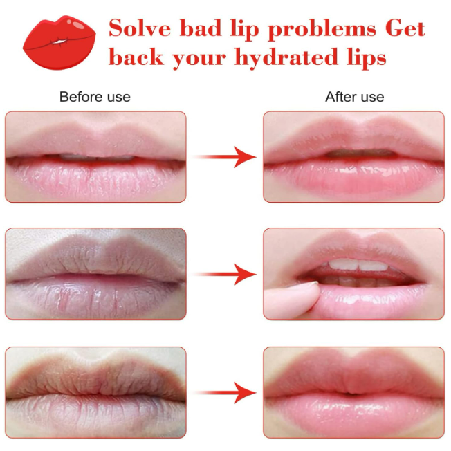 Charm Kiss – 20pcs Hydrating Lip Masks